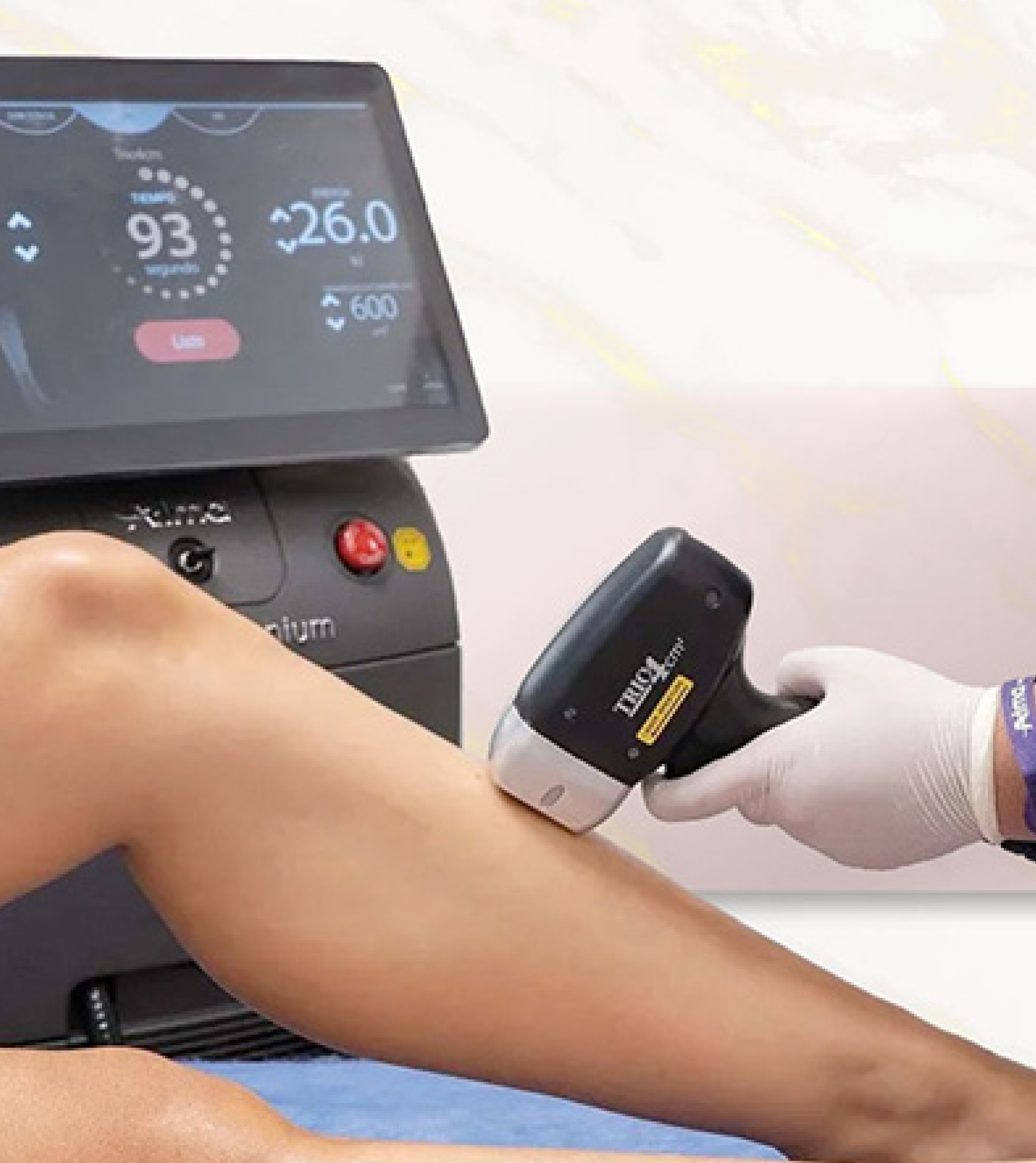 Laser hair removal treatment at Skin Plus Delhi